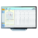 ECG MACHINE 12 LEAD AMEDTEC PC BASED (100434) EA