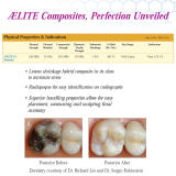 AeLite LS Low Shrinkage A3 Syringe (4gm)