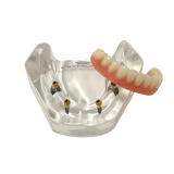 Locator Full Patient Model Kit (4 Patient Models)