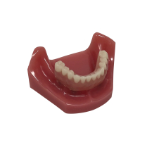 Locator Fixed Patient Model