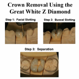 Great White Z Kit For Zirconia (4 Bur Kit)